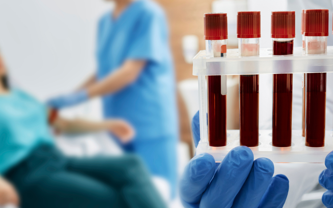 Jakie badania krwi robić raz w roku?