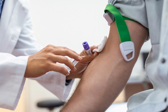 Badania krwi – jak się przygotować?